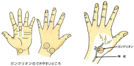 言葉の語感から別のものを想像するトピ