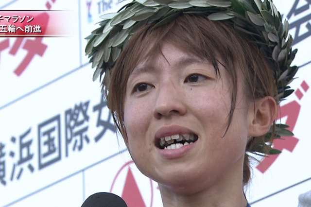 歯列矯正体験談