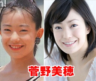 菅野美穂は結婚してから目と鼻を整形していた！？