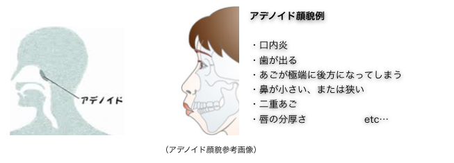 梅干しジワに悩んでる方