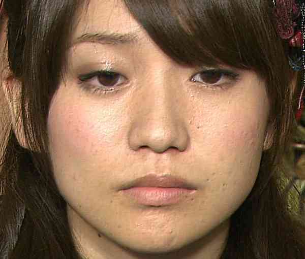 ストレスが身体に出る人