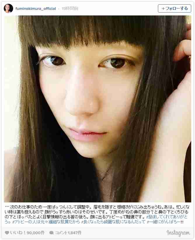 木村文乃のアトピーに大反響「勇気もらった」「励まされた」「ビックリした」 - シネマトゥデイ