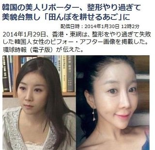 もし友達に整形し過ぎな人がいたらどうしますか?