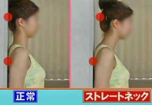 ストレートネックに悩んでる人