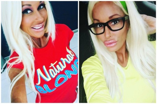 5,600万円かけて全身を整形しリアル・バービーを目指す女性