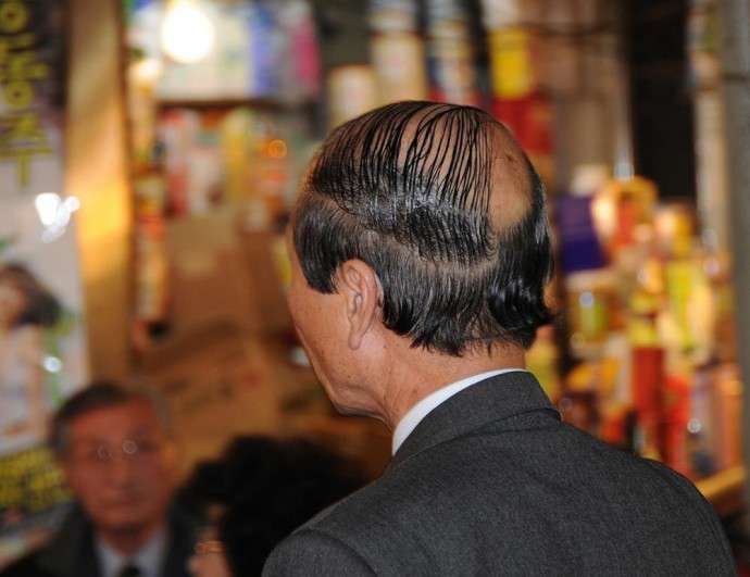 もしも彼氏や旦那がカツラだったらどうしますか?
