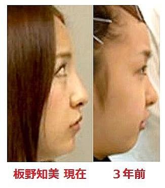 横顔に自信のない人