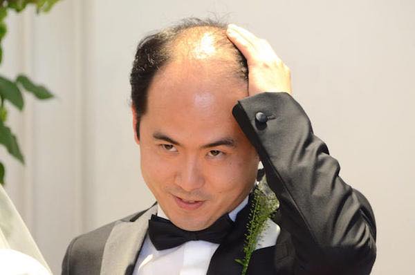 もしも彼氏や旦那がカツラだったらどうしますか?