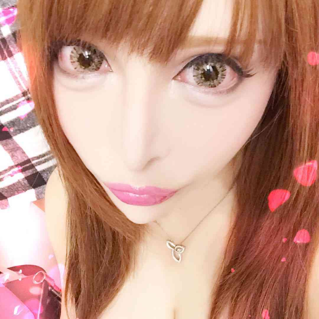 【閲覧注意】整形サイボーグ・ヴァニラがアゴ削りすぎ…？肉体の限界を心配する声