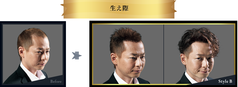 もしも彼氏や旦那がカツラだったらどうしますか?