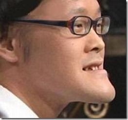 受け口、しゃくれの人語り合いませんか？(ToT)