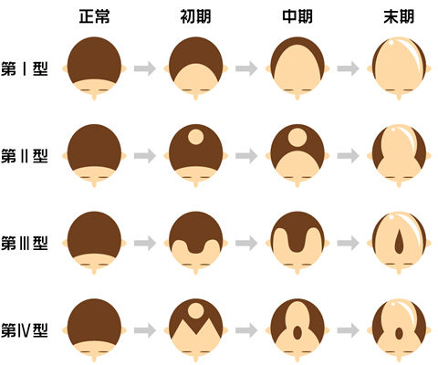 子供に似て欲しくない旦那のこんなところ