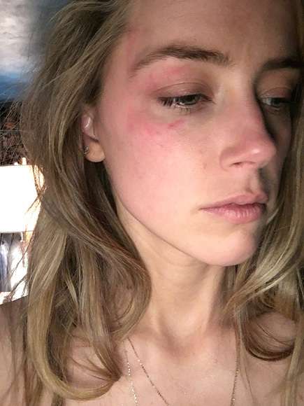 ジョニー・デップ、アンバー・ハードに家庭内暴力？妻への接近禁止命令下る