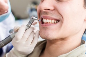 ３ヶ月に一度！歯医者でPMTCを行った方がいい６つの理由と費用や手順