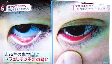 目眩の経験がある方いませんか？