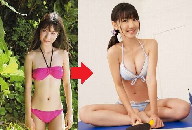 恐らく豊胸だろうなと思う有名人