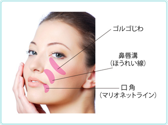 目の下のたるみ