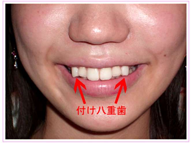 肥満が美とされる国もある! 古今東西10の女性の美しさの基準