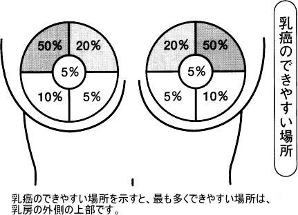 「しこり」だけじゃない。Facebookに驚きの乳がん写真を投稿した女性の思い