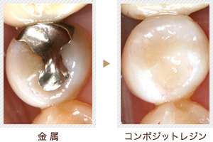 最近の歯医者について