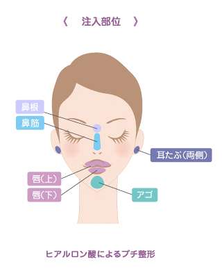 注射だけ……気軽にできる「プチ整形」でまさかの失明！