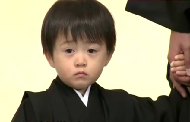 目の下のたるみ