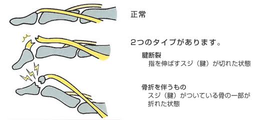 【±判断】この症状病院へ行きますか？
