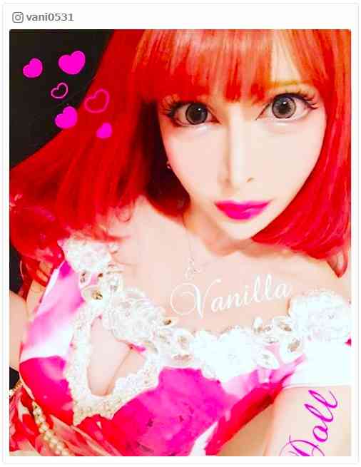 総額3600万超“整形サイボーグ美女”、日本の最新技術に不満「あばら骨を取りたい」 医師から警告も - モデルプレス