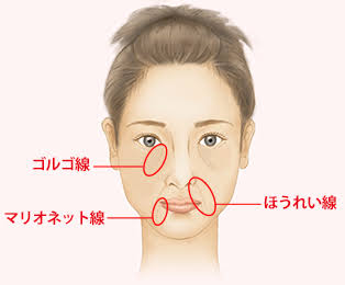 ゴルゴ線ある人？