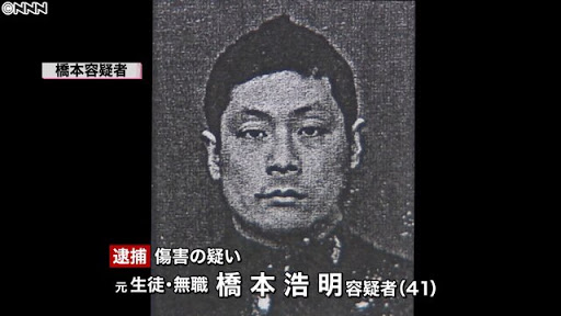 バレエ教室講師の指切断の疑い 生徒の男を逮捕