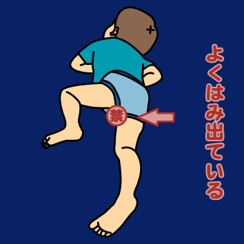 ちょっとエッチだけど笑える思い出