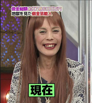 業界人が目撃して「笑えないほど変貌した」女性芸能人3名とは?