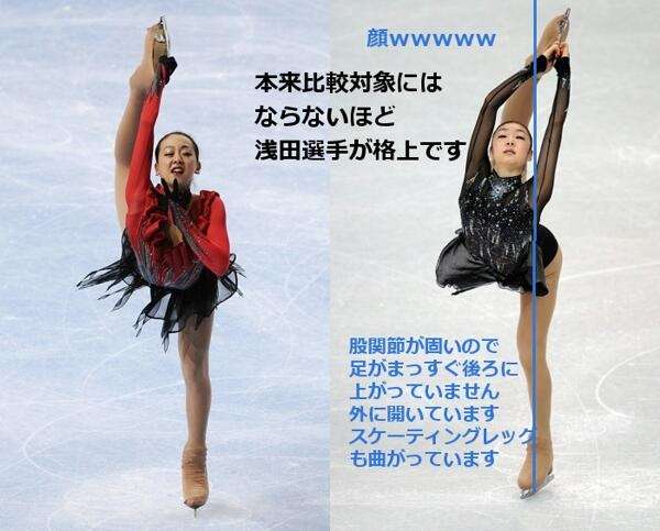 キム・ヨナが日本の芸能界デビューを狙って大整形手術