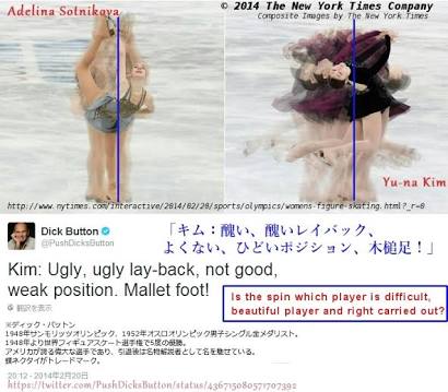 キム・ヨナが日本の芸能界デビューを狙って大整形手術