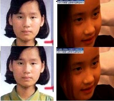 キム・ヨナが日本の芸能界デビューを狙って大整形手術