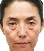 外見、どんな老化現象が出ていますか？