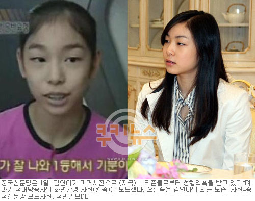 キム・ヨナが日本の芸能界デビューを狙って大整形手術