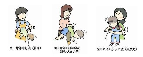 フランクフルトがのどに詰まり小5死亡 学校の野外活動