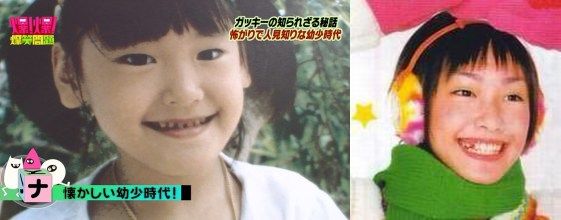どうして美容整形すると劣化するんですか？