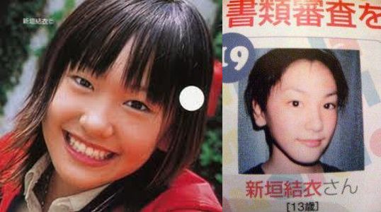 どうして美容整形すると劣化するんですか？