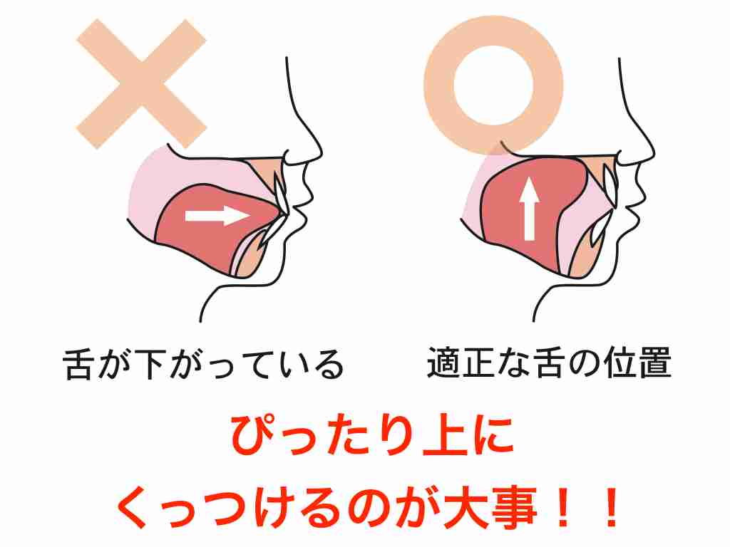 横顔がブスな人