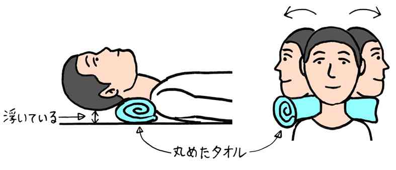 ストレートネックの人