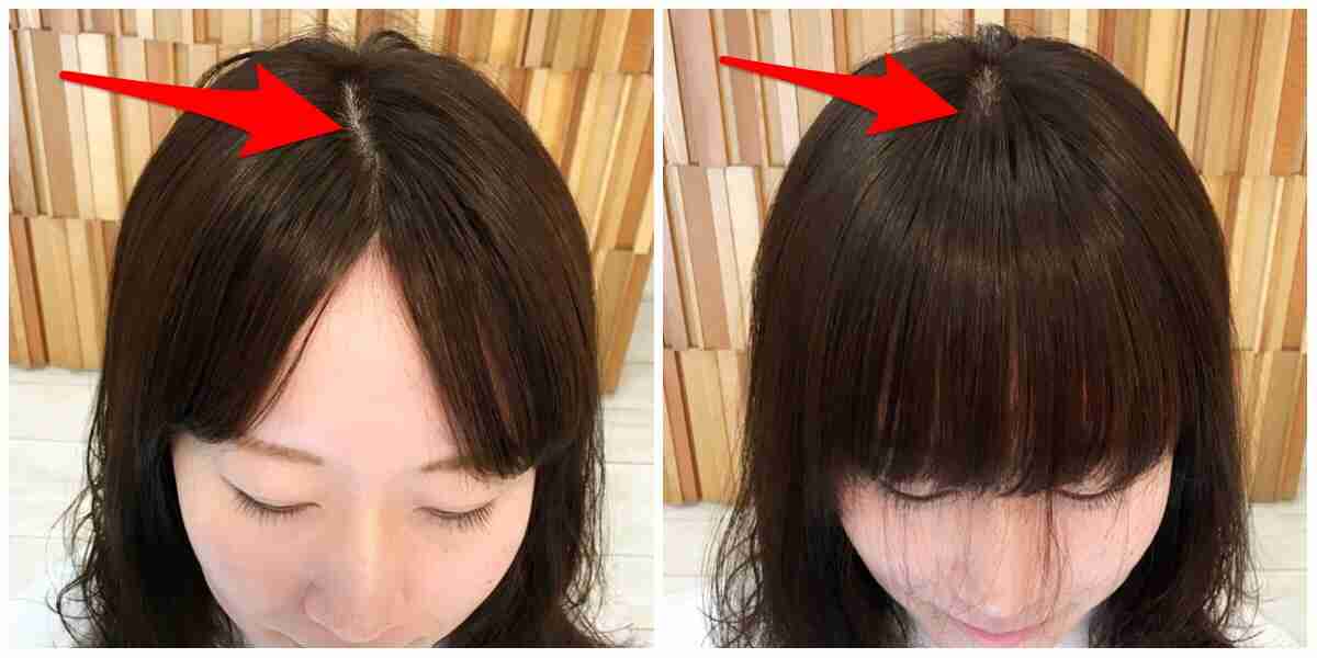 美容（主に顔）に関して相談するトピ