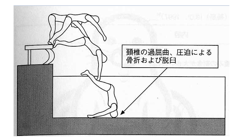 岐阜でプール飛び込み事故　学校のプール　溺水防止で低い水深(内田良) - 個人 - Yahoo!ニュース