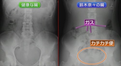 腸もみ・腸活について語りたい