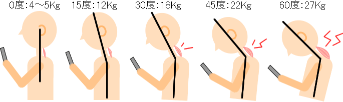 ストレートネックの人
