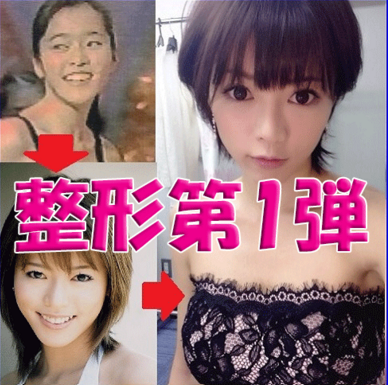 どうして美容整形すると劣化するんですか？