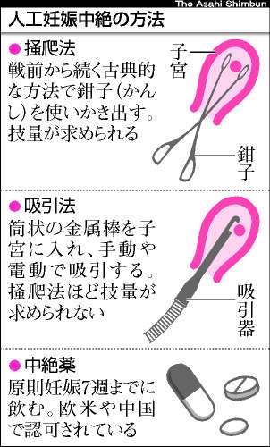 中絶手術の恐ろしい「万が一」 子宮壁に穴が開き女性が死亡(米)