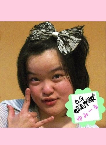 芸能人の触覚アリヘア、ナシヘアの比較画像