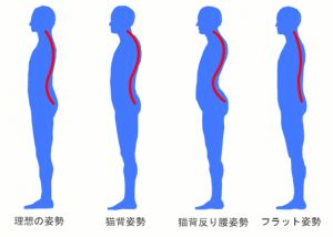 反り腰の人